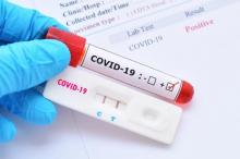APSM apoia clubes nos testes Covid-19, contribuindo assim para uma maior segurança sanitária.